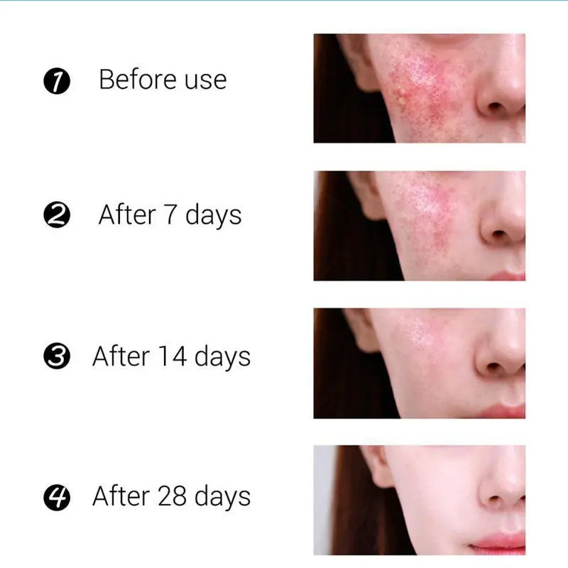 Anti-Acne Freckle Shrinking Pores Routine Essentials Studio