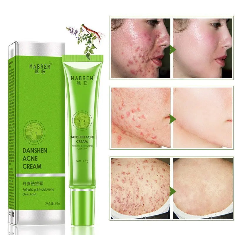 Anti-Acne Freckle Shrinking Pores Routine Essentials Studio